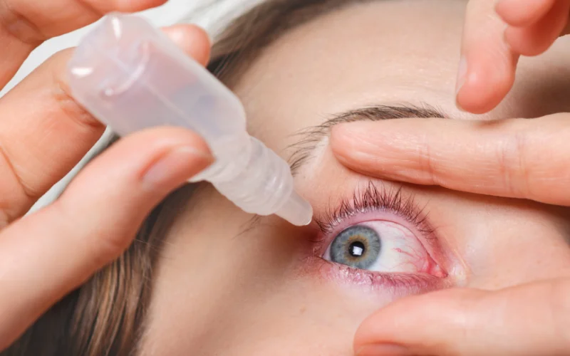 Pink Eye Treatment Online in Alaska